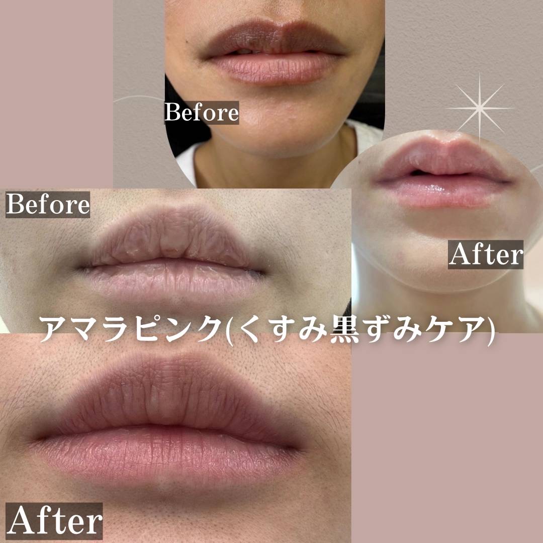 リップ アマラピンク