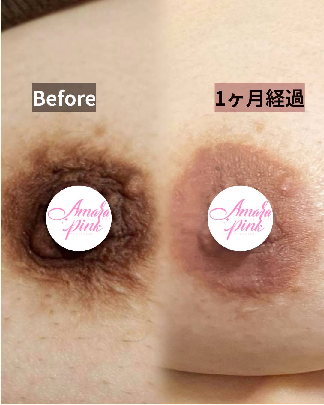 アマラピンク